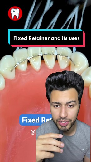 What is fix retainer and its uses | #foryou #foryoupage #healthadvice #learnontiktok #fitdentistofficial #retainer