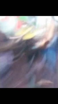 Why Kneecap Matter #shorts