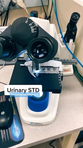 32K views · 329 reactions | Urine microscopy 朗 #lablife #microbiology | Lab life | Facebook