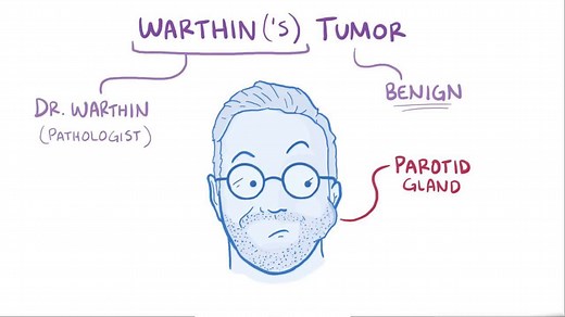 Video: Warthin tumor - Video Explanation! | Osmosis | Osmosis