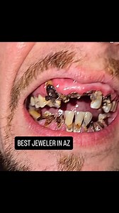 @kuad_the_jeweler Changing Lives In AZ, Need A Grill…. Contact @kuad_the_jeweler 💎 | Midhaga Gerado