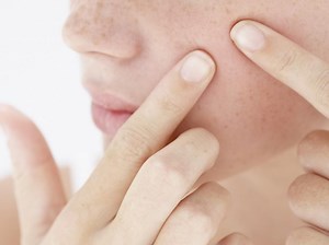 VIDEO. 216.000 abonnés fans du perçage de bouton...