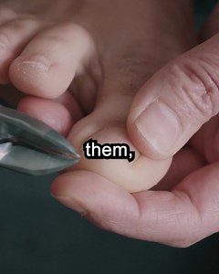 8.7M views · 315 reactions | Embarrassing toenail fungus getting out of hand? No worries! EMUAIDMAX® has a 5-star formula that delivers safe healing ingredients to stubborn and difficult-to-treat nail fungus. | Emuaid | Facebook