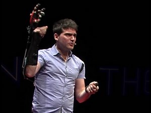 Open innovation for our bionic future | Minas Liarokapis | TEDxThessaloniki