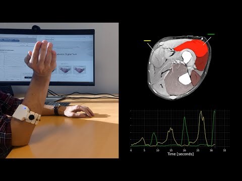 Functional Muscle Imaging demo by Neurodec