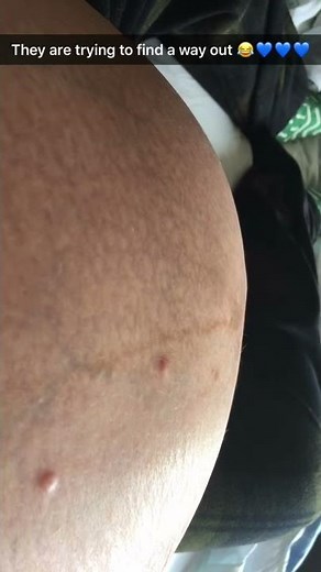 Triplets Moving Around - 34 Weeks Pregnant