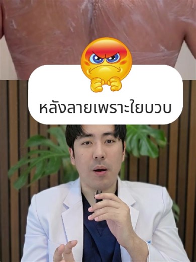 หลังลายเพราะใยบวบ ยิ่งขัด ยิ่งดำ? #ใยบวบ #ขัดตัว #ขัดหลัง #หลังลาย #Frictionamyloidosis #หมอพาร์ท #พิลนาคลินิก #สาระความรู้ #ผิวหนัง