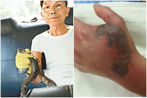 Man gets bitten by cobra in Pok Fu Lam, poses with snake en route to hospital | Coconuts