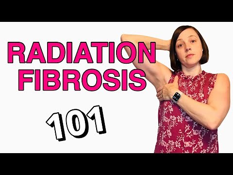 Radiation Fibrosis Side Effects - What You Need to Know