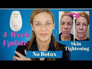 Newa Beauty Radio Frequency Device Before and Afters | No Botox, No fillers | Mature Women | Over 40