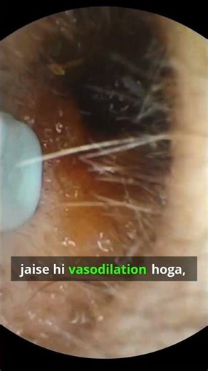 Allergy Swelling Secret UNLOCKED! 🤯 This IgE/Histamine domino effect explains the dreaded Edema.