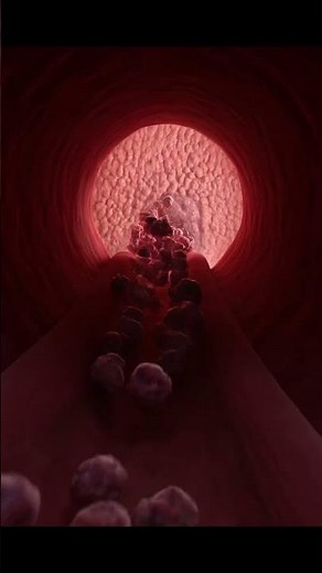 How Cancer Actually Spreads Inside Your Body (Metastasis) 😱
