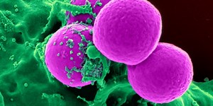 Scientists Train Immune Cells to Gobble Up Cancer | Cancer