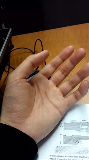 Uni Medical care on Instagram: "A 20-year-old male presents with involuntary twitching of the thumb when flexed, along with similar twitching of the index finger when bent, difficulty extending the fingers, and forearm weakness. The symptoms began a year ago, became more pronounced after weightlifting sessions, and persisted even after discontinuing exercise. Nerve conduction studies, thyroid function tests, electroencephalography (EEG), and brain magnetic resonance imaging (MRI) were all normal