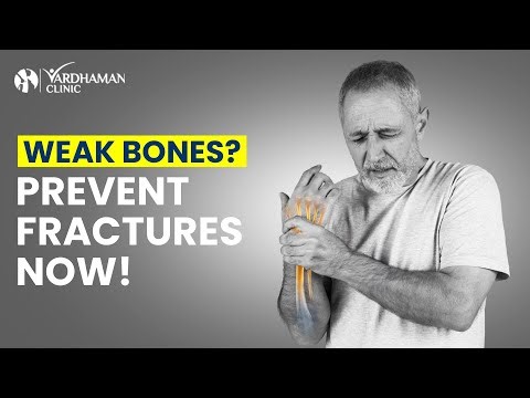 Prevent Osteoporosis Naturally with Simple Lifestyle Changes