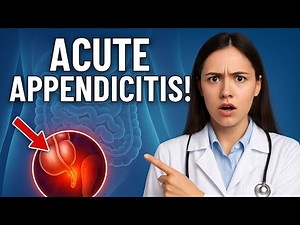 Acute Appendicitis Explained | Symptoms, Diagnosis & Treatment Made Simple