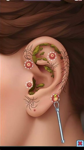 “Satisfying Ear Cleaning ASMR | Ear Doctor Game”