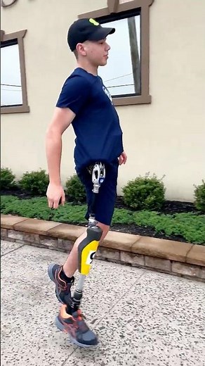 Hemipelvectomy Amputee Running with Prosthetic Leg | Kristofer