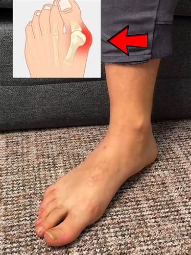 Big toe alignment method #fyp #foryou #viral #trending #the_craftingzone