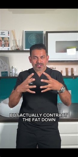 Does Morpheus8 Melt Fat? The Truth Explained