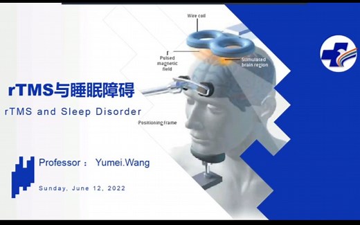 经颅磁刺激（rTMS）与睡眠障碍