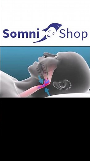 Endlich RUHE: Die Schnarchschiene #schnarchen #schnarchschiene #somnishop