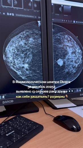 ОНКОМАММОЛОГ | ХИРУРГ | PhD | ЖУМАКАЕВА САБИНА САКЕНКЫЗЫ on Instagram: "🎗️С 18 лет ежегодное посещение маммолога и прохождение УЗИ молочных желез-рак молодеет, если раньше пик заболеваемости приходился на 60-65 лет, то сейчас нередки случаи выявления у молодых девушек 🎗️с 40 лет скрининг-маммография, это бесплатное рентгенологическое исследование молочных желез в поликлинике по месту жительства, проводится каждые 2 года (40, 42, 44 и тд) 🎗️ томосинтез- есть только в филиалах @divera_karaganda