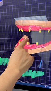 77K views · 534 reactions | for double arch! | Luke Kahng | Facebook