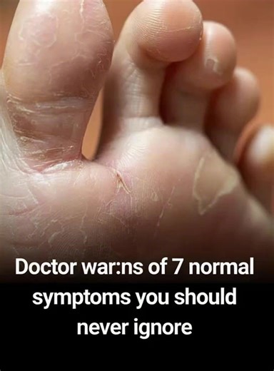 When it comes to our health, many of us wait until a problem becomes too obvious to ignore before seeking medical attention. However, some health issues may manifest in more subtle, easily overlooked symptoms that might not immediately scream "eme.rgency." 😲 | Feedy