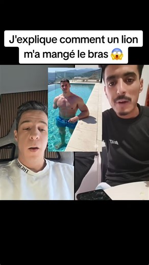 Un lion m'a mangé le bras : l'incroyable prank !