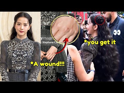 Wait!! Jisoo really hurt her hand because she fought with zombies?! Oh the details of flower🥲
