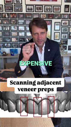 Master Dental Scanning: Tips & Tricks Revealed! #shorts