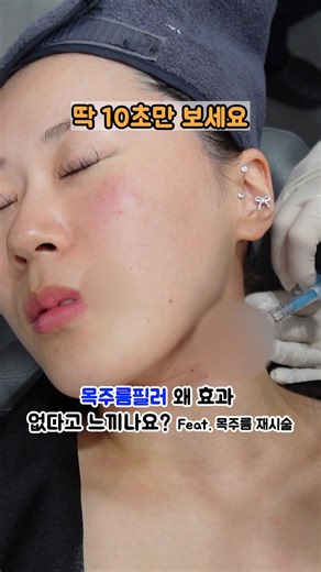 목주름필러 왜 효과 없다고 느끼나요? 3가지가 충분했는지 체크해보세요! 목주름지우개 후기!