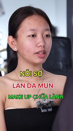 Cách Make Up Che Khuyết Điểm Cho Da Mụn