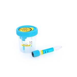[Hot Item] Disposable Specimen Container Microtainers Urine Cup Urine Container Urine Collection for Analysis Machine