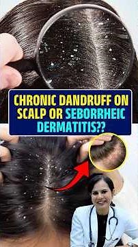 Chronic Dandruff on Scalp or Seborrheic Dermatitis?? #Dandruff #SeborrheicDermatitis #ScalpCare