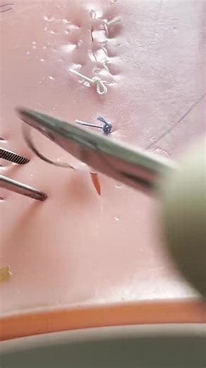 Locking horizontal mattress stitch | Dermhacks