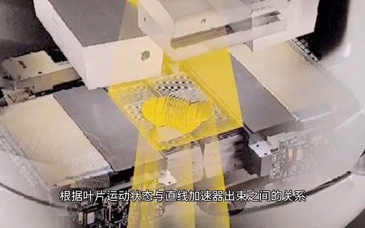 什么是调强放疗