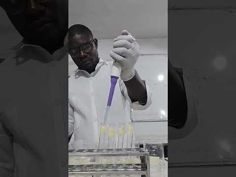 HOW TO CARRYOUT ANTHRONE TEST TO DICTATE CARBOHYDRATES.