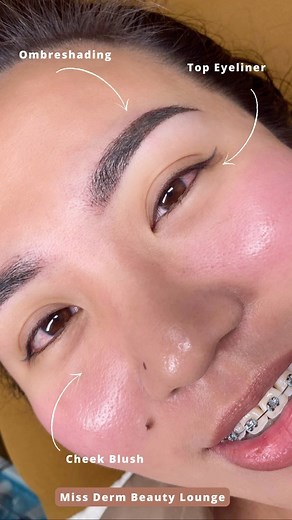 Be like Ai. Living the woke-up-like-this style 🤎 Ready brows, eyeliner and blush to save your time. (Cheek blush will still subside after a little scabbing). PM us now to book your consultation. Branches: Makati, Las Piñas and Quezon City #topeyeliner #cheekblush #ombreshading #pmuartist #missderm #pmu #spmu #browgoals #rosycheeks #permanentmakeup #microblading #metromanila | Miss Derm