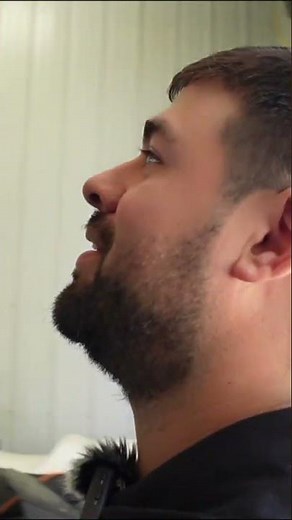 L5P Duramax Denali Ultimate Front End Swap !!