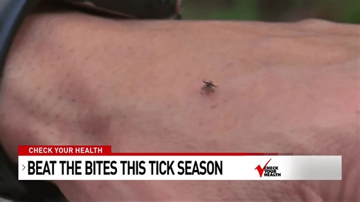 Check Your Health- Beat the Bites this Tick Season