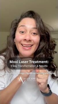 Moxi Laser Treatment: 5 Day Transformation & Results