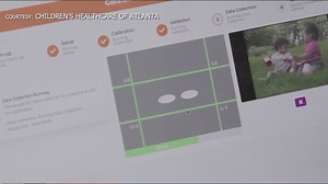 Eye-tracking system helps diagnose autism