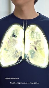 Magaling maglinis ng lungs at advance magpagaling ang Carbocisteine Zinc (Solmux Advance Liquid). Recover in as fast as 3 to 5 days when taken thrice daily. If symptoms persist, consult your doctor. ASC Ref. No. U0171P041425S | Solmux Advance