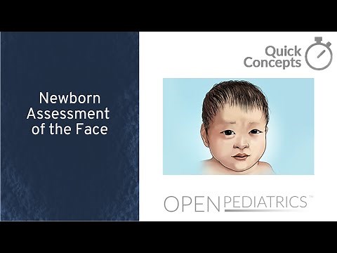 Newborn Assessment of the Face by N. Gold | OPENPediatrics