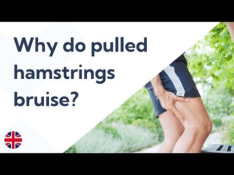 Why pulled hamstrings bruise and how to treat the bruise