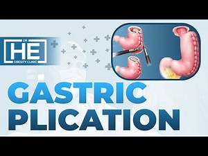 Gastric Plication Animation Video | Dr HE Obesity Clinic
