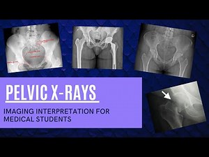 Pelvic X-Rays for Medical Students