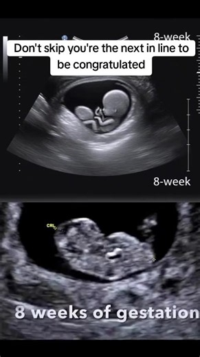 #baby #ttc #infertility #ivf #pregnancy | baby